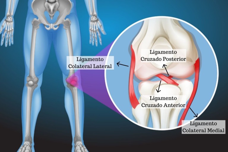 Les O No Ligamento Cruzado Anterior Do Joelho Sintomas E Tratamento