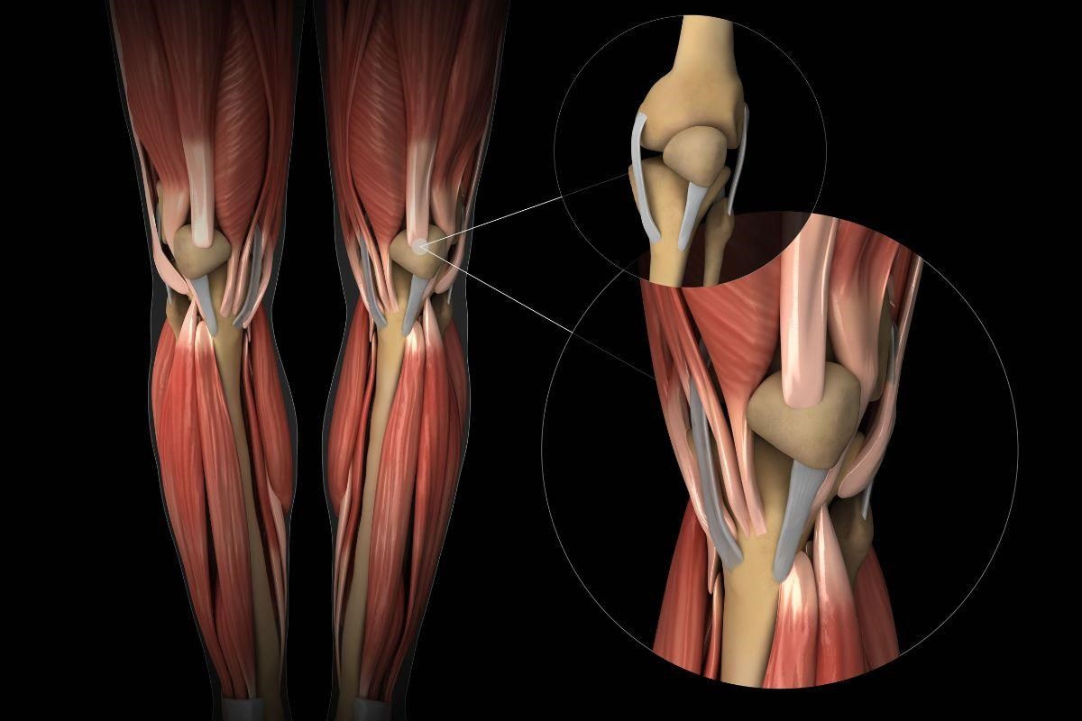 Leia mais sobre o artigo Rompimento de ligamento do joelho: quais os sintomas?